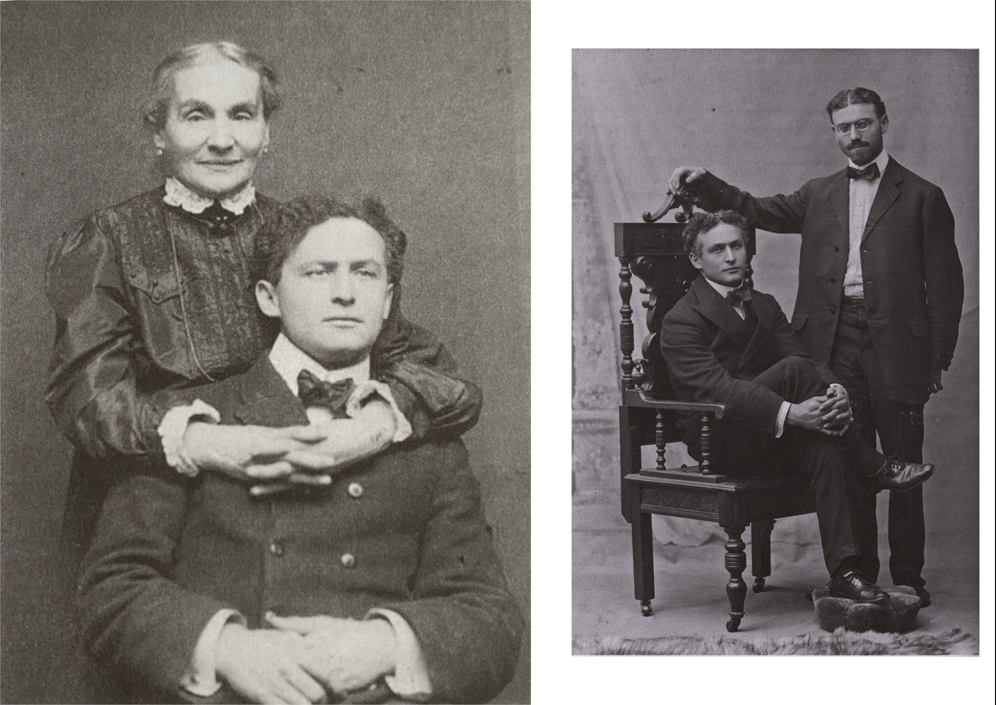Houdini édesanyjával, valamint öccsével Leopolddal, aki orvosként gyakran felügyelte a bűvész fizikai felkészülését. Forrás: Silverman, 2006.